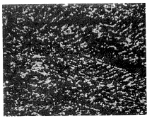 圖3 失效模具試樣殘留鑄態(tài)樹(shù)枝狀偏析 ×40 圖3 失效模具試樣殘留鑄態(tài)樹(shù)枝狀偏析 ×40